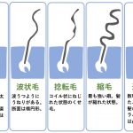 【髪のお悩み】くせ毛の原因や種類って?治す方法はあるの?